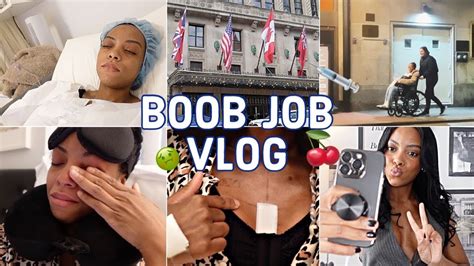 I got a BOOB JOB *Vlog* my experience, cost + 3 month updates!!.